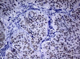 NBN / Nibrin Antibody (aa461-754, clone OTI1G1)