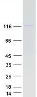 Human CBLB Protein (Recombinant Myc-DDK (Flag))