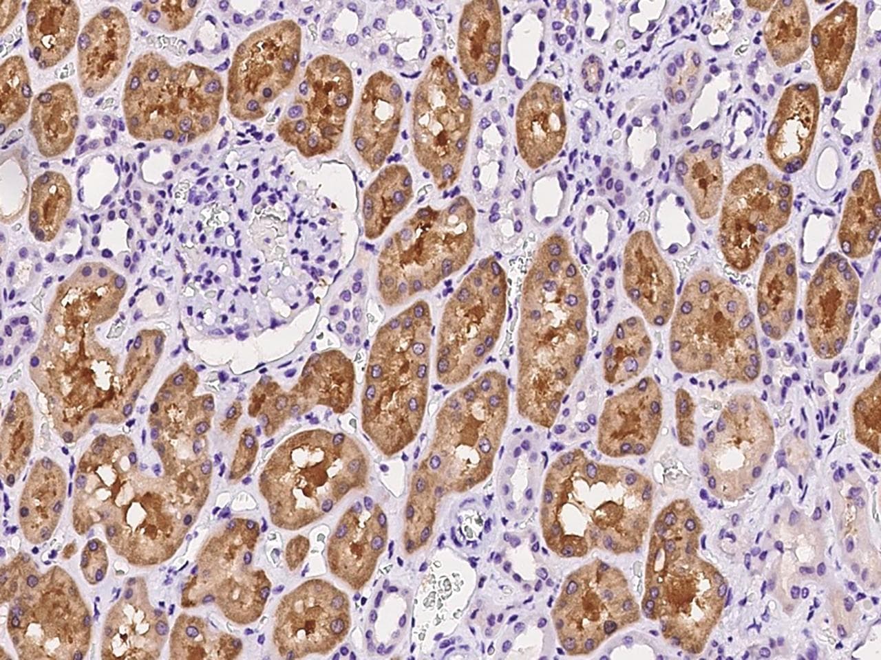 PSMF1 Antibody