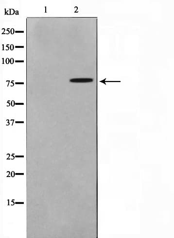 TGM2 / Transglutaminase 2 Antibody