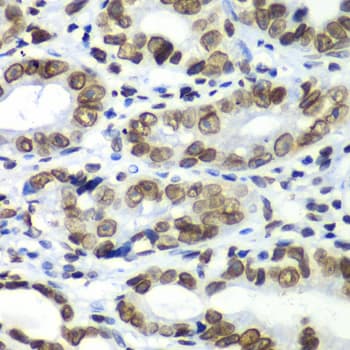 TEAD1 Antibody