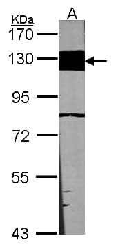 IHC-plus™ LAMB3 / Laminin Beta 3 Antibody (aa644-960)