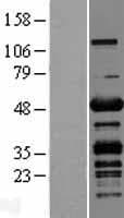 PLEKHO1 / CKIP-1 Protein (Over-Expression Lysate Myc-DDK (Flag))