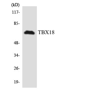 TBX18 Antibody (aa111-160)