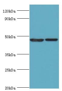 SUV39H2 Antibody (aa201-410)