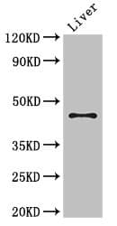 Polyclonal Rabbit anti-Human RHD Antibody (IHC, IF, WB)