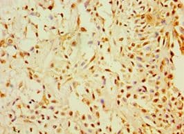 CALR3 Antibody (aa135-384)