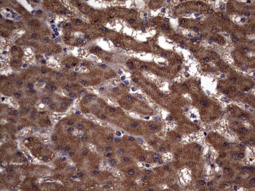 IL1RN Antibody (clone OTI2B1)