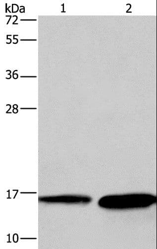 Polyclonal Rabbit anti-Human HINT2 Antibody (IHC, WB)