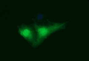 IDO1 / IDO Antibody (clone OTI1E11)