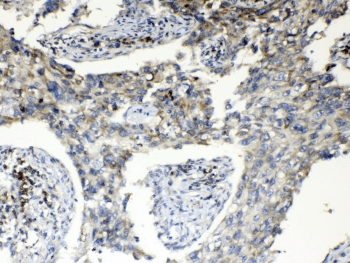 RPS6 / Ribosomal Protein S6 Antibody
