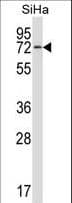 HSPA12B Antibody (aa108-136)