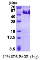 Human BASP1 Protein (Recombinant His)