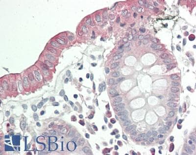IHC-plus™ CO-029 / TSPAN8 Antibody (aa110-160)