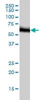 RNMT / HCM Antibody (clone 3H3-1D12)