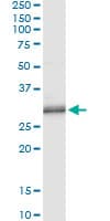 PNMT Antibody (clone 3G4)