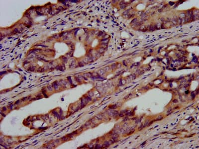 Polyclonal Rabbit anti-Human UBE2G1 Antibody (IHC, IF)