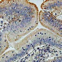 Polyclonal Rabbit anti-Human FZR1 Antibody (IHC, IF, WB)