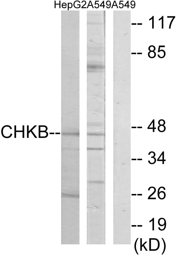 Polyclonal Rabbit anti-Human CHKB / CHKL Antibody (aa301-350, WB)