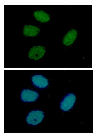 TIP49 / RUVBL1 Antibody (clone AT1D6)