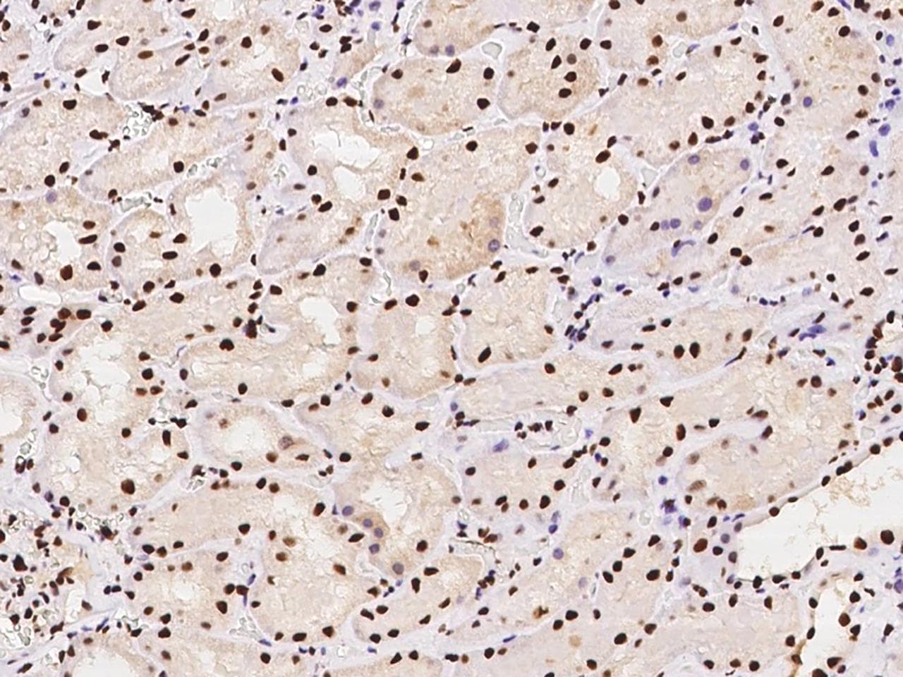 Polyclonal Rabbit anti-Human DCPS Antibody (IHC, IF)
