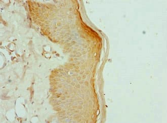KIF2B Antibody