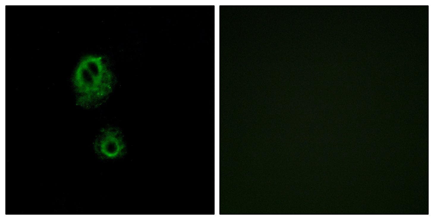 Polyclonal Rabbit anti-Human MRGPRG Antibody (IF, WB)