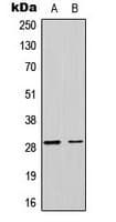 MRPL17 Antibody (C-Terminus)