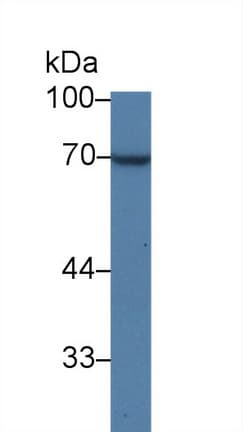 QSOX1 / QSCN6 Antibody (aa37-181)