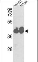 PathPlus™ IDH1 / IDH Antibody (aa116-143)