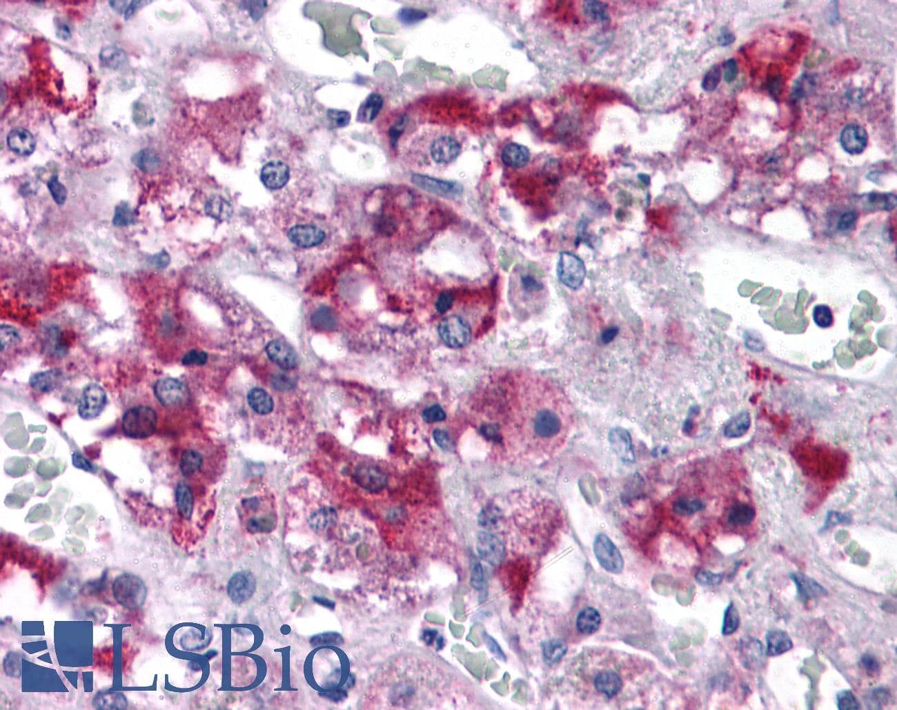 IHC-plus™ Polyclonal Rabbit anti-Human RIMS2 / RIM2 Antibody (IHC)