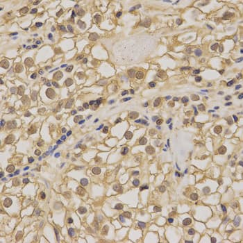 NME1 / NM23 Antibody