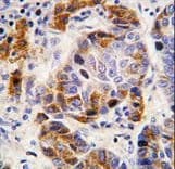 Polyclonal Rabbit anti-Human P5CDH / ALDH4A1 Antibody (aa288-314, IHC, WB)