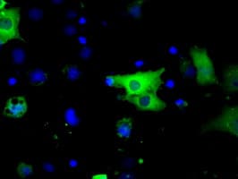 Monoclonal Mouse anti-Human BTK Antibody (clone OTI10E10, IHC, IF, WB)