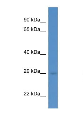 RAB5C Antibody (aa109-158)