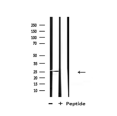 Polyclonal Rabbit anti-Human EFNA2 / Ephrin A2 Antibody (IF, WB)