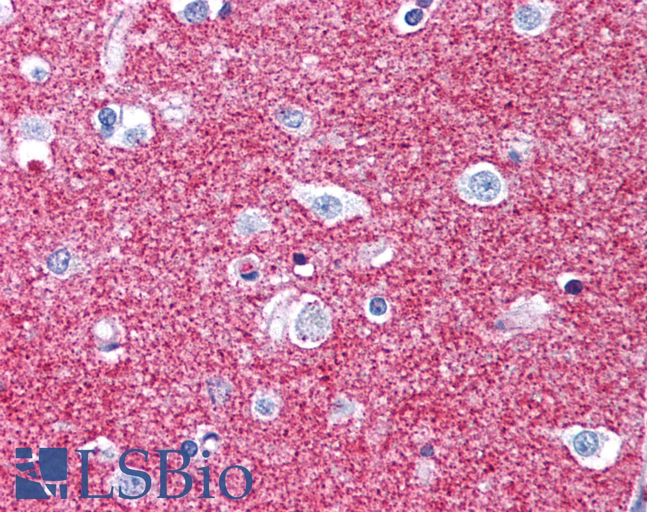 PathPlus™ GAP43 Antibody