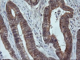 MAP2K3 / MEK3 / MKK3 Antibody (clone OTI5F2)