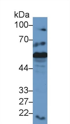 CALR / Calreticulin Antibody (aa199-308)