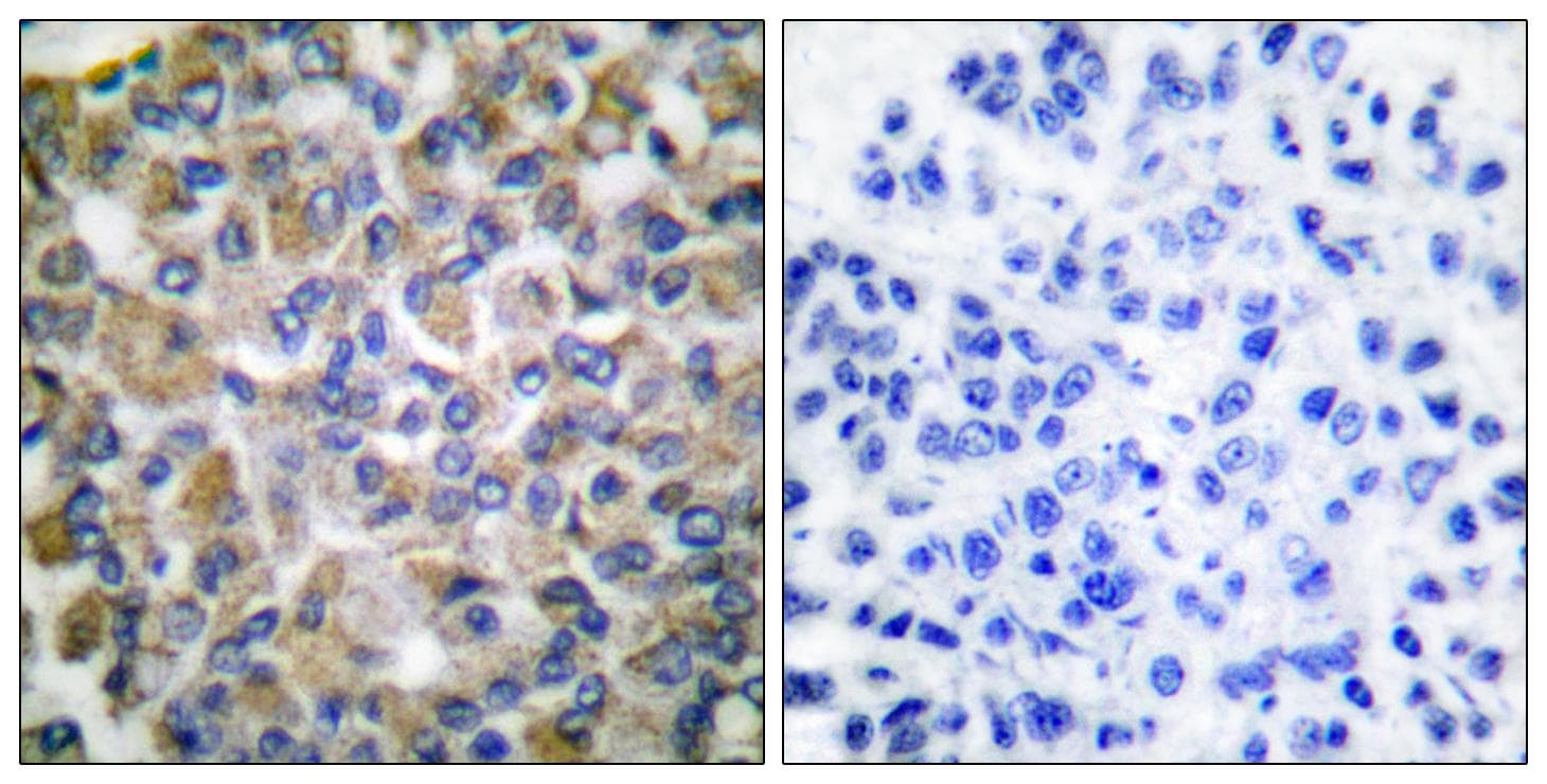 Polyclonal Rabbit anti-Human HSPA9 / Mortalin / GRP75 Antibody (IHC, IF, WB)