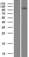 TSHZ1 Protein (Over-Expression Lysate Myc-DDK (Flag))