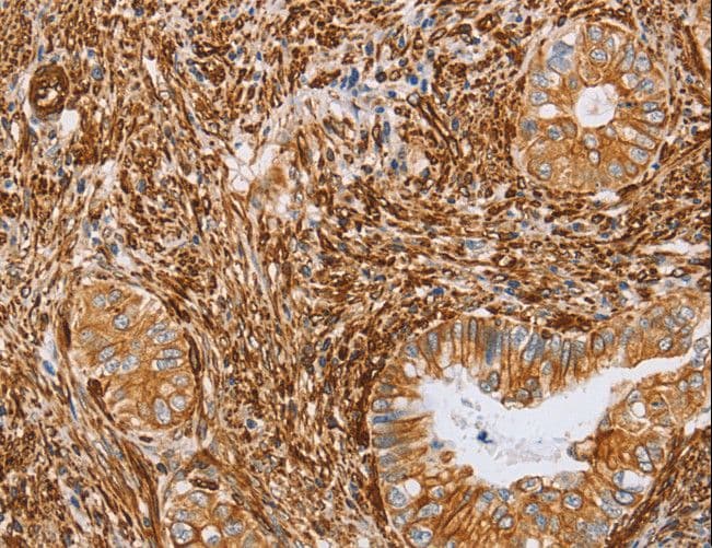 Polyclonal Rabbit anti-Human BRS3 Antibody (IHC)