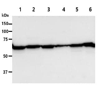 IHC-plus™ PGM1 / Phosphoglucomutase 1 Antibody (clone AT84G2)