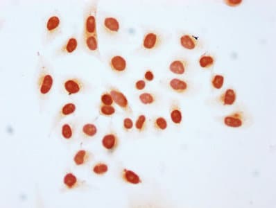 HIST1H1C Antibody