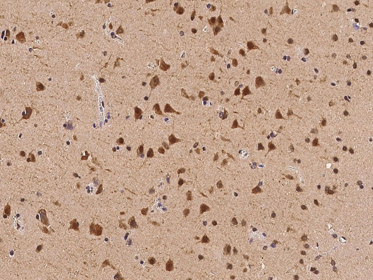 Polyclonal Rabbit anti-Human TEX13B Antibody (IHC)