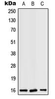 RPS19 / Ribosomal Protein S19 Antibody (Internal)