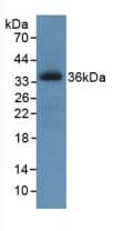 ROS1 / ROS Antibody (Cy3)