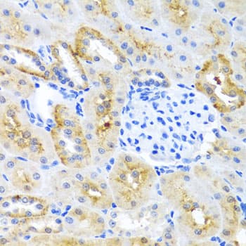 MOK / RAGE Antibody