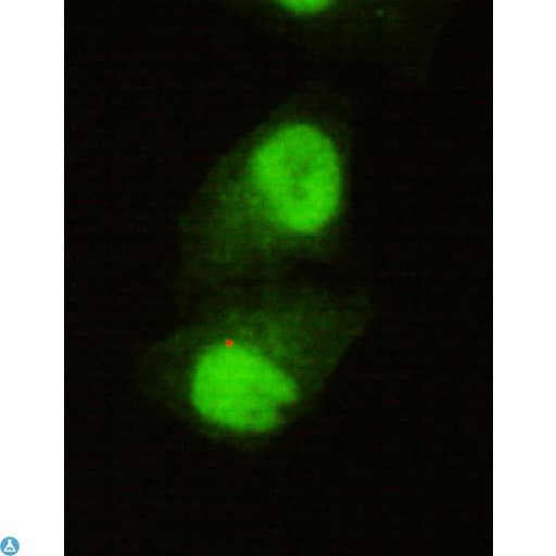 KDM5C / Jarid1C / SMCX Antibody
