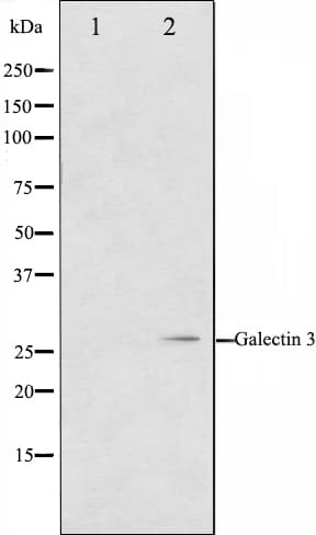Polyclonal Rabbit anti-Human LGALS3 / Galectin 3 Antibody (IHC, IF, WB)